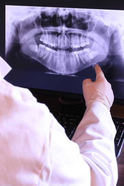 Best Emergency Tooth Extraction in Abbeville, GA